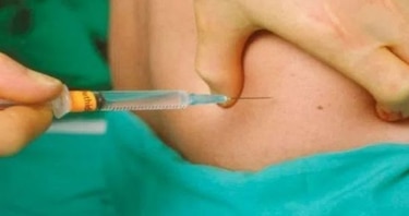 Nueva ley regula el uso de biopolímeros y otras sustancias en Panamá: multas de hasta $50 mil