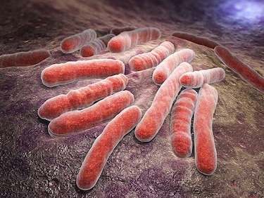 Esfuerzos para prevenir la septicemia