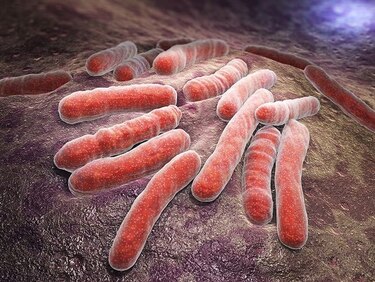 Esfuerzos para prevenir la septicemia