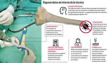 Regulan uso de aloinjertos procesados en trasplantes