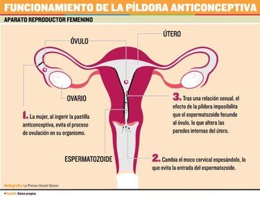 Confiable anticoncepción