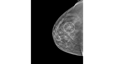 Las prioridades de la investigación en salud