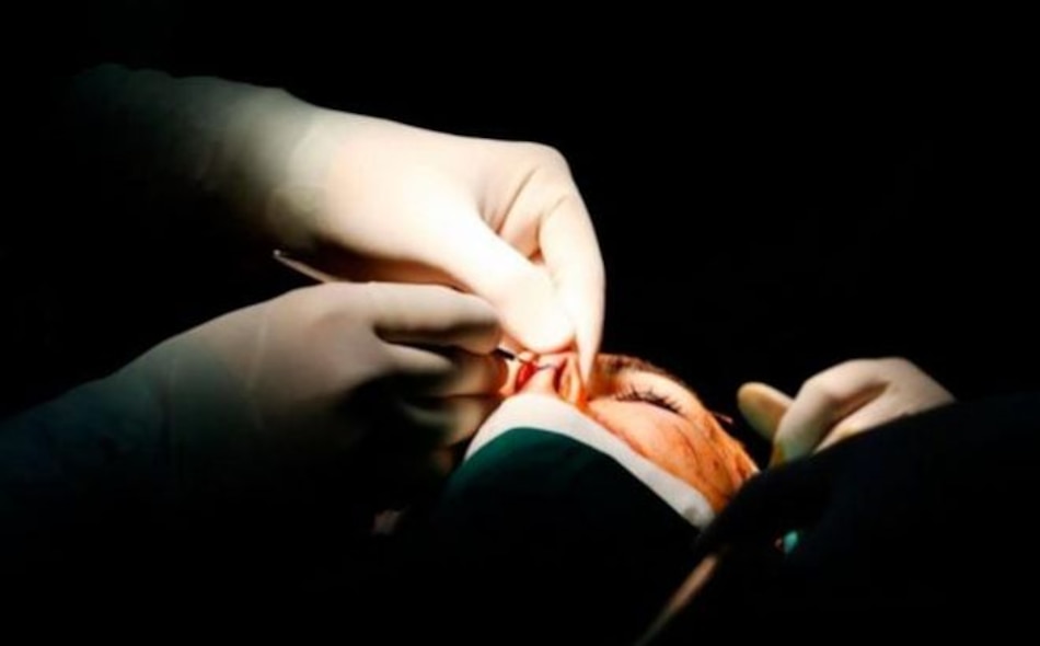 Reiteran que los procedimientos de cirugía plástica solo deben ser realizados por personal idóneo