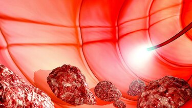 La era de la biología molecular de los tumores malignos