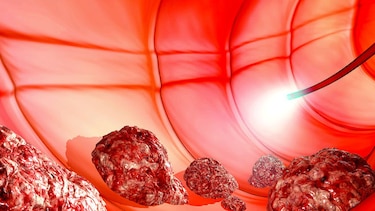 La era de la biología molecular de los tumores malignos