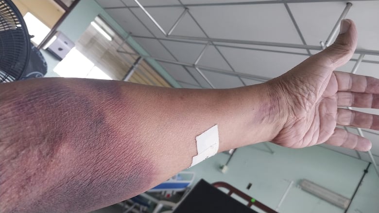 Crisis en urgencias: el triste relato de un paciente sobre la atención médica en la CSS