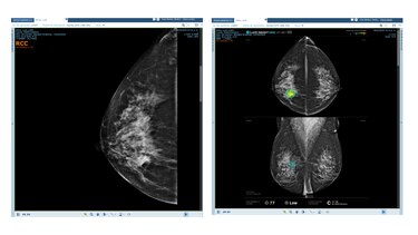 Historias que transforman vidas: La apuesta de Maxia por la salud en Panamá con Inteligencia Artificial
