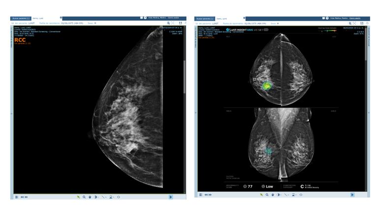 Historias que transforman vidas: La apuesta de Maxia por la salud en Panamá con Inteligencia Artificial