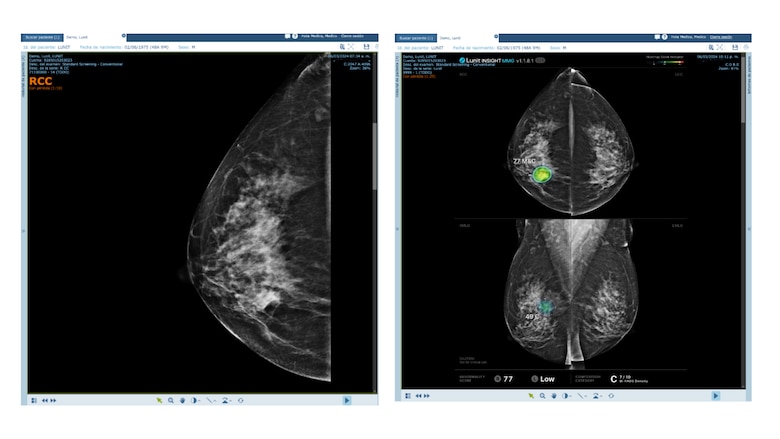 Historias que transforman vidas: La apuesta de Maxia por la salud en Panamá con Inteligencia Artificial