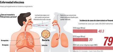 Panamá, en una batalla que no cesa contra la tuberculosis