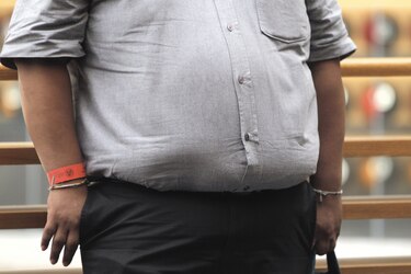 Más de mil millones de personas de todo el mundo sufren obesidad