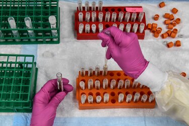 Hidrocortisona reduce la mortalidad de enfermos graves de coronavirus, según un estudio