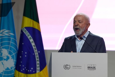 Lula se sometió ‘sin complicaciones’ a un procedimiento para retirar una lesión de piel