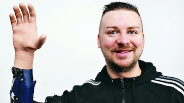 Tres austriacos con manos biónicas