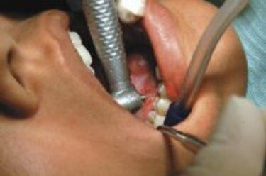 Tratamiento odontológico