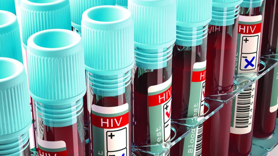 5 mitos sobre el VIH/sida (segunda parte)