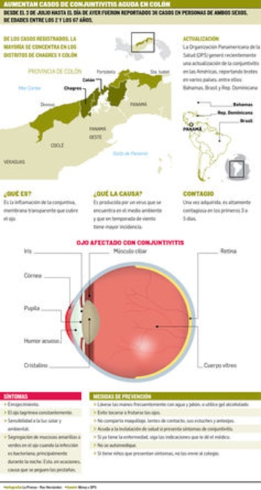 Minsa detecta aumento de casos de conjuntivitis aguda en Colón