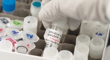 Varias vacunas contra el nuevo coronavirus deberían aprobarse en 2021, afirma científico británico