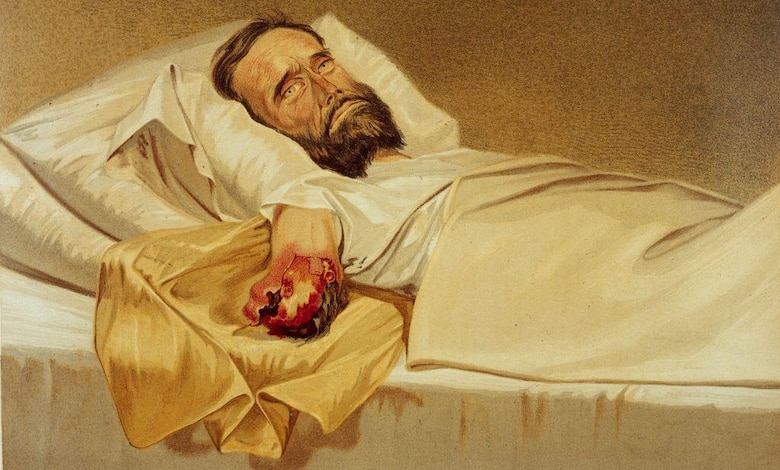 Joseph Lister, el cirujano que tuvo la brillante idea de desinfectarse las manos (e inspiró a los creadores de Listerine y Johnson & Johnson)