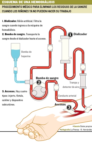 Jóvenes, enfermos de los riñones