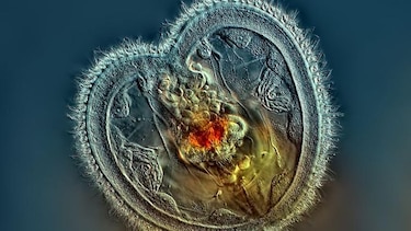 El arte de fotografiar microorganismos