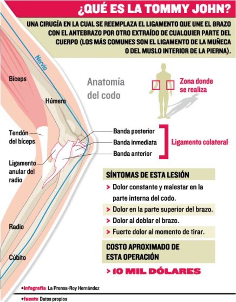 La operación Tommy John
