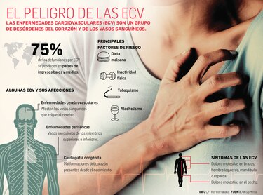 Esperanza de vida en una cirugía