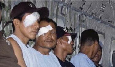 Crisis deja 52 heridos en los ojos