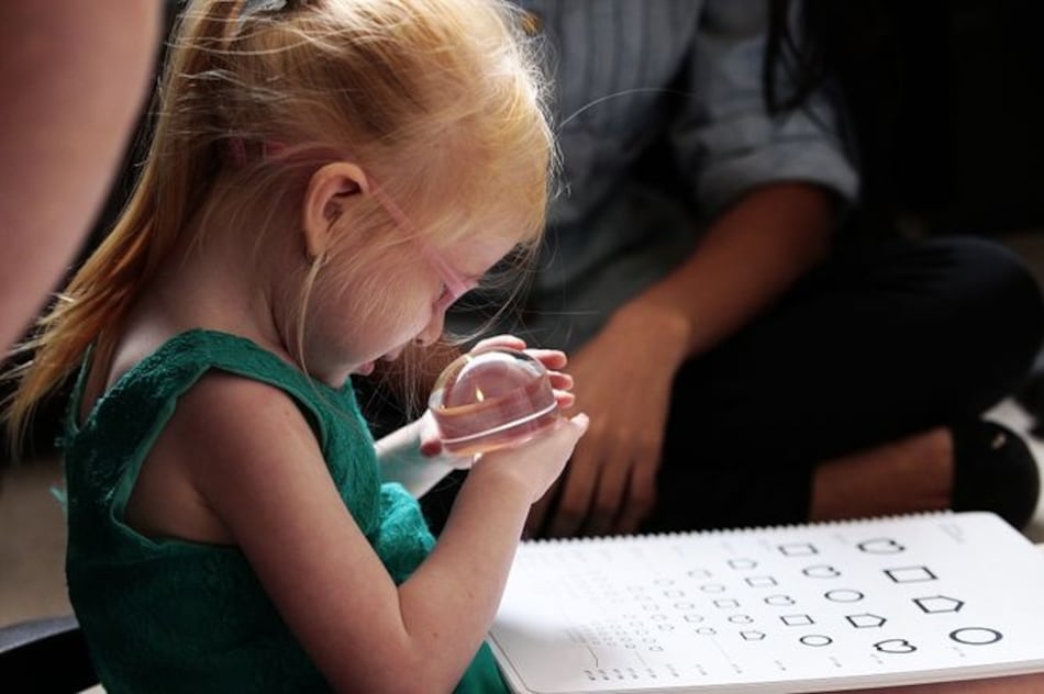 12 mitos del albinismo