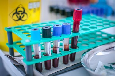 Casos de malaria siguen en aumento en Panamá