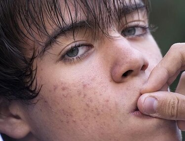 Onicofagia y ansiedad: cuando la tensión se expresa a través de ciertas conductas