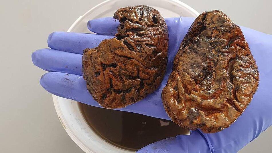 La científica que colecciona cerebros antiguos y busca descifrar por qué pueden perdurar hasta miles de años