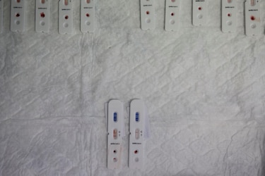Un estudio revela que la covid-19 deteriora el sistema inmunitario a largo plazo