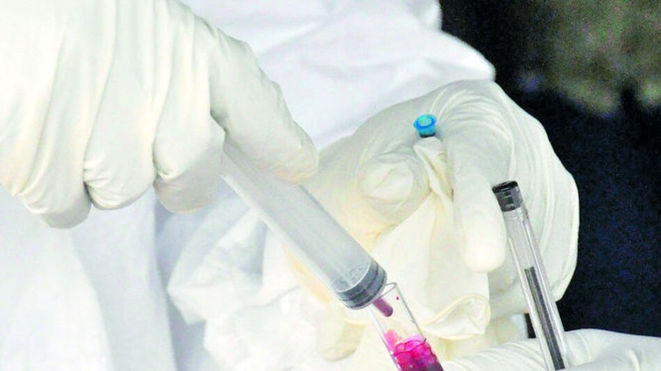 Desarrollan un método de análisis de sangre que ayuda a mejorar los tratamientos contra el cáncer