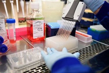 Estados Unidos reporta la primera muerte por peste bubónica en 2025
