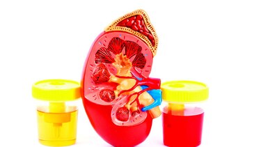 5 mitos de la sangre en la orina (hematuria)