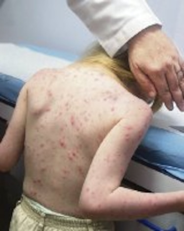 Las lentejas no ayudan