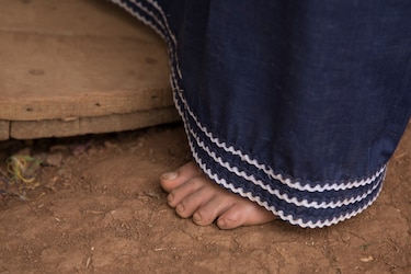 200 mil personas padecen hambre y 700 mil no pueden pagar una dieta saludable