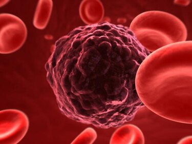 La medicina avanza contra el cáncer con nuevas armas inteligentes