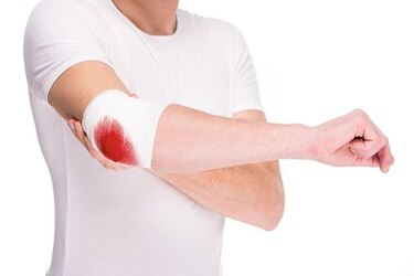 Hemofilia: el mal que inhibe la coagulación en la sangre