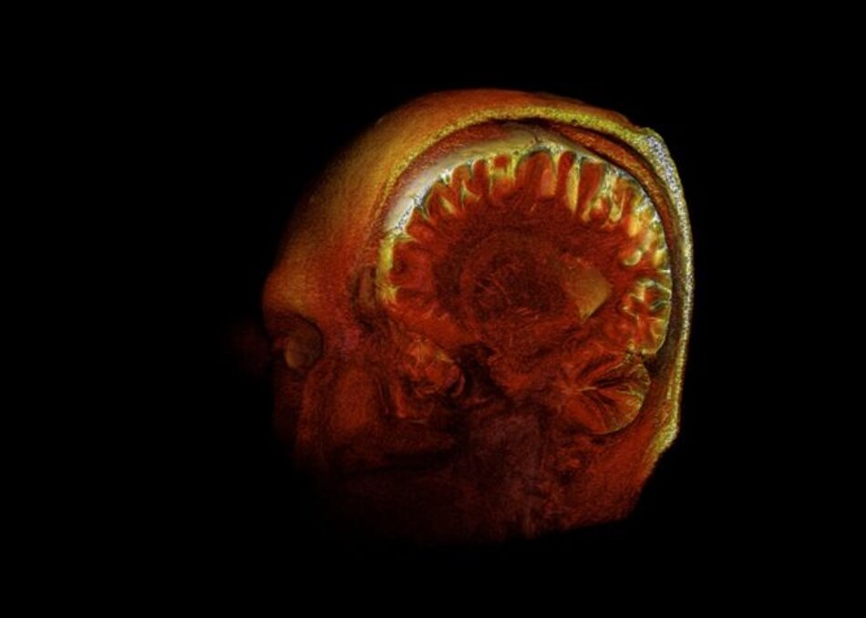 El cerebro, la última frontera