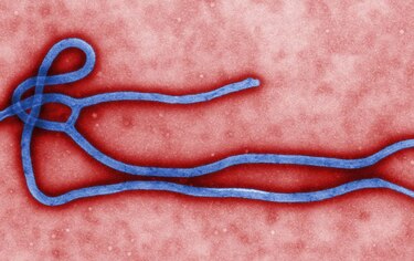El ébola remite, pero otros países siguen siendo vulnerables