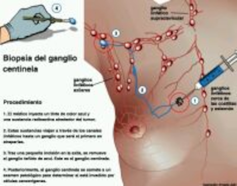 Ciencia De profesión, centinela