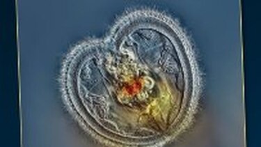 Un panameño gana concurso de fotos de microorganismos