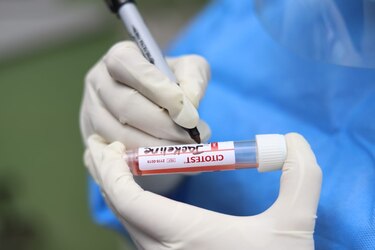 Panamá, sin lograr el control esperado de la epidemia: Néstor Sosa
