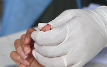 Organizaciones que trabajan en la prevención del VIH solicitan reunión al ministro de Salud