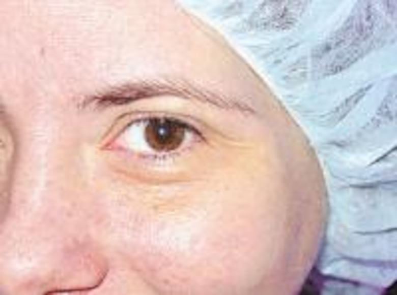 Innovador cambio de color de ojos