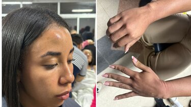 Policía Nacional afirma que la representante Arielis Barría no presentó fractura, pese a denuncias en redes sociales