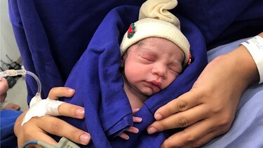 Nace en Brasil el primer bebé concebido gracias a un útero trasplantado de una fallecida