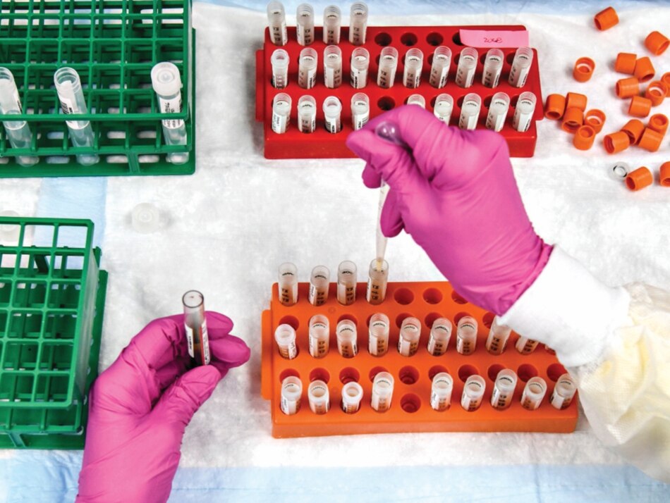 Ensayo clínico de vacuna contra la Covid-19 se atrasa por logística